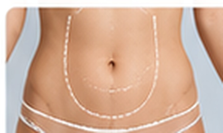 Body contouring and liposuction